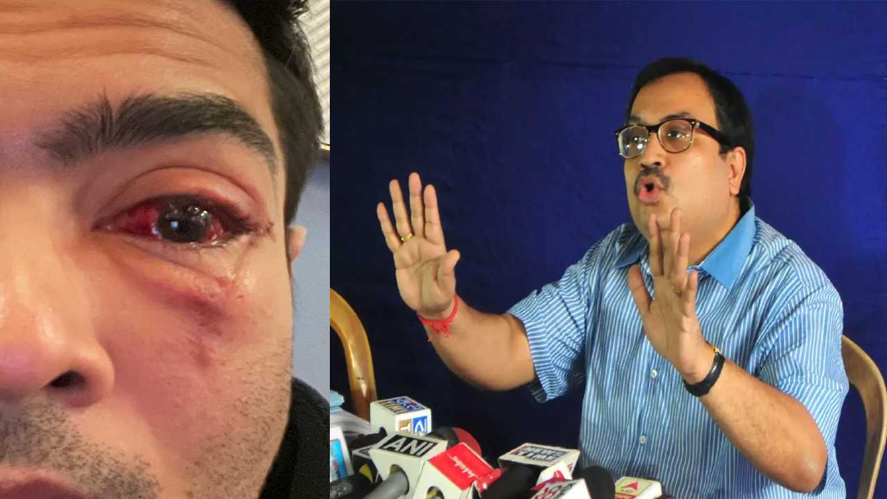 Abhishek Banerjee eye condition: “অভিষেকের চোখের অবস্থা দেখুন!”, বিরোধীদের সমালোচনার জবাবে টুইট কুণালের